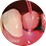 Oral photodynamic therapy system SOGA PDT-I