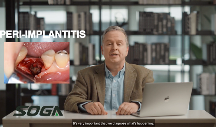 laser peri implantitis