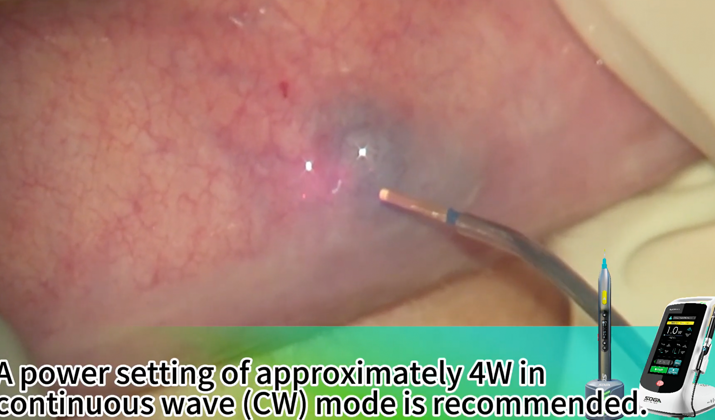 New treatment plan for hemangioma: Unlock in 1 minute!